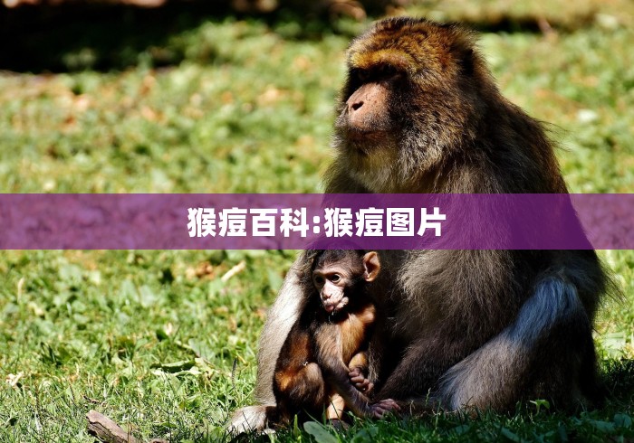 猴痘百科:猴痘图片
